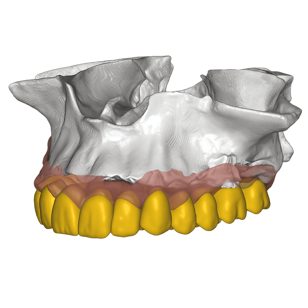 Digital Wax Up